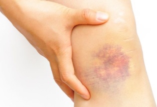 Seguimento despois da operación